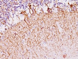 NF-H Antibody (SPM145), Novus Biologicals 0.2mg; Unlabeled:Antibodies,